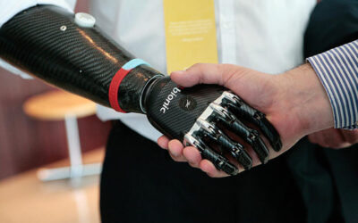 تقنية الطباعة ثلاثية الأبعاد للأطراف الصناعية: الابتكار الجديد من شركة Halfmoon